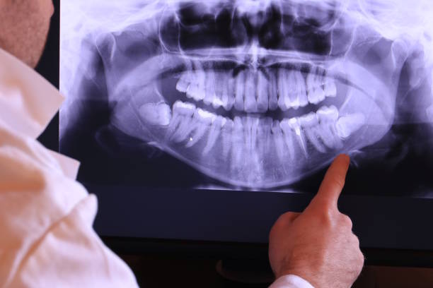 Best Walk-In Emergency Dental Services in Rutherfordton, NC