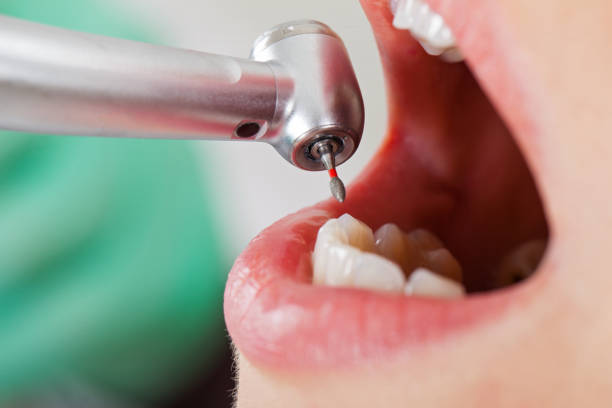 Best Weekend Emergency Dental Services in Rutherfordton, NC